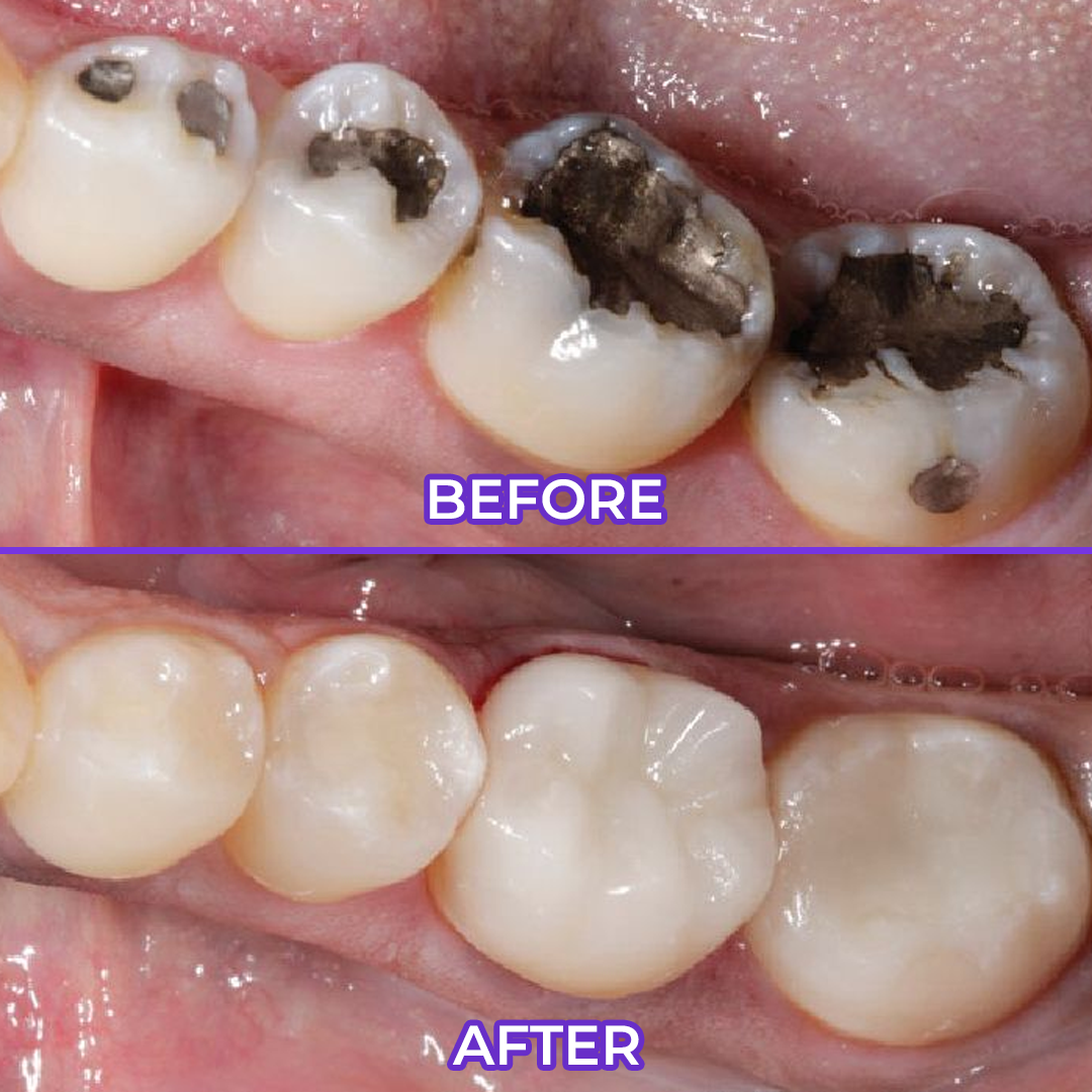DarkFairy Fluoride Toothpaste