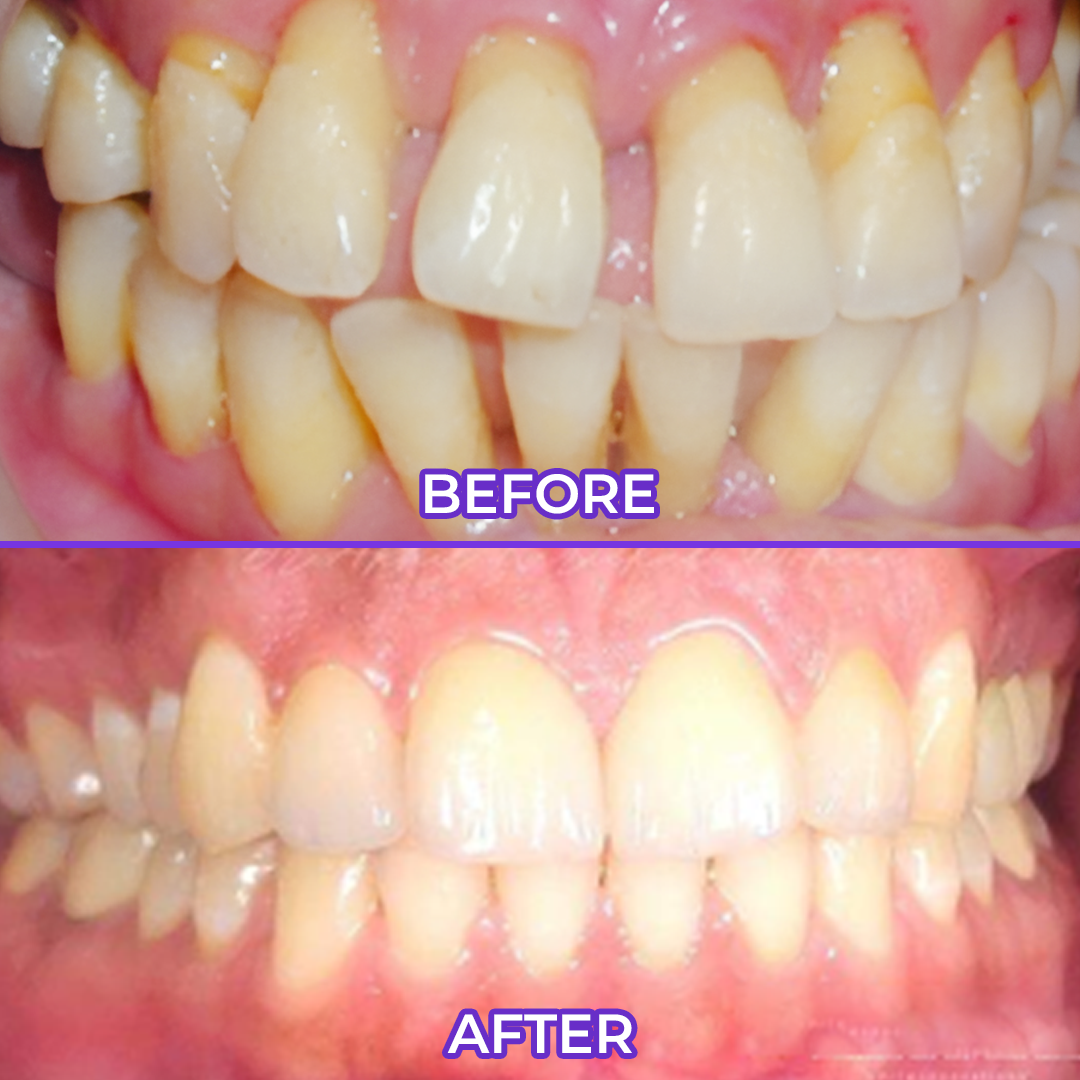 DarkFairy Fluoride Toothpaste
